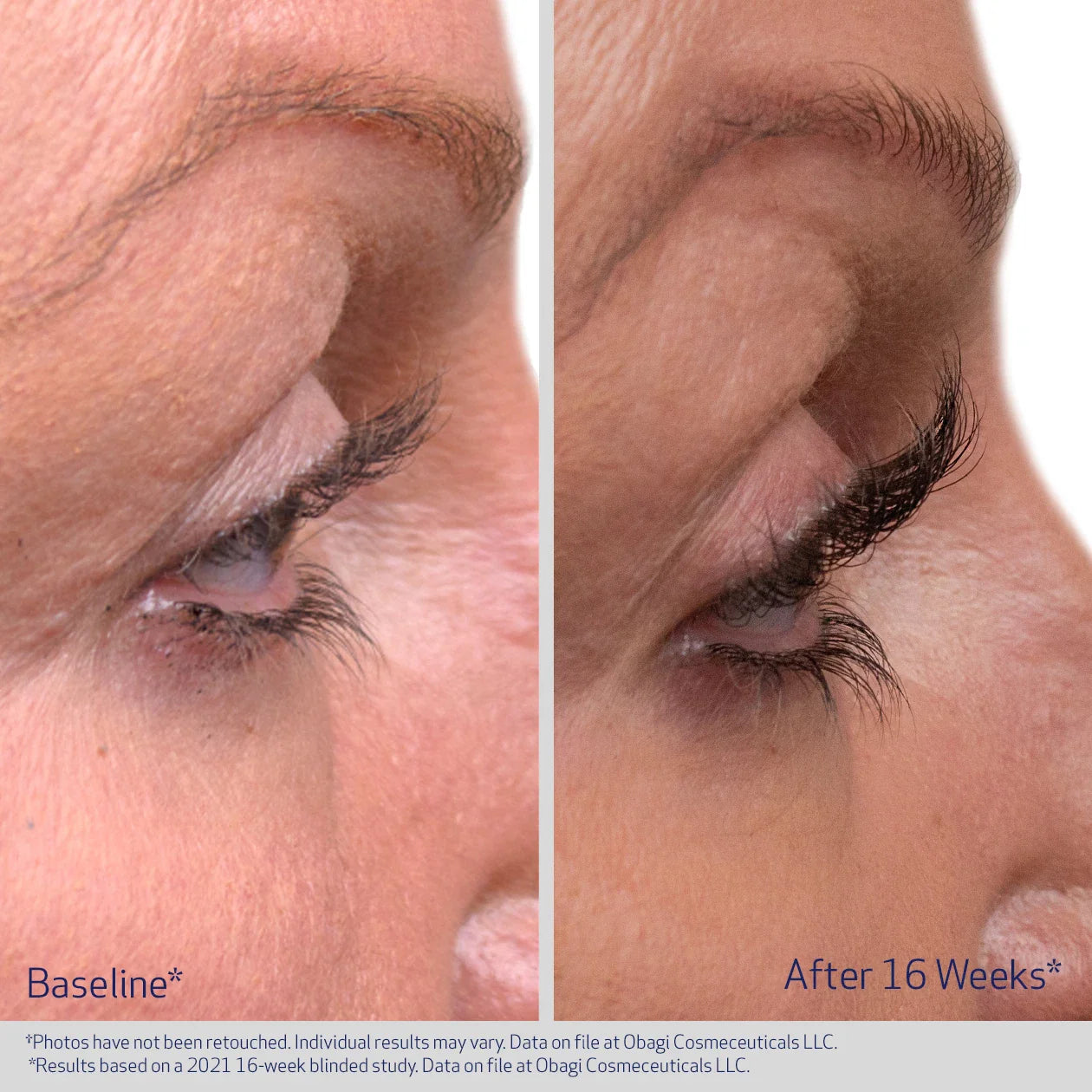 OBAGI NU-CIL® EYELASH ENHANCING SERUM Medical Grade Nourishing Lash Serum