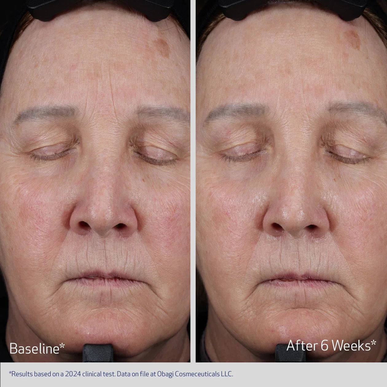 OBAGI ELASTIDERM® LIFT UP & SCULPT FACIAL MOISTURIZER Firming and Plumping Cream