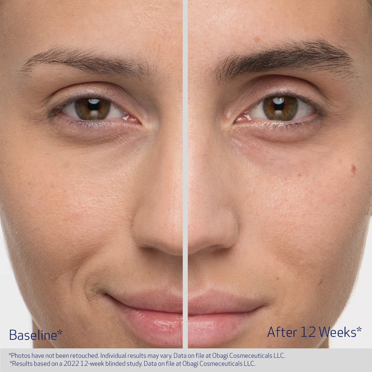 OBAGI OBAGI NU-CIL® EYEBROW BOOSTING SERUM Nourishing Eyebrow Enhancing & Thickening Serum