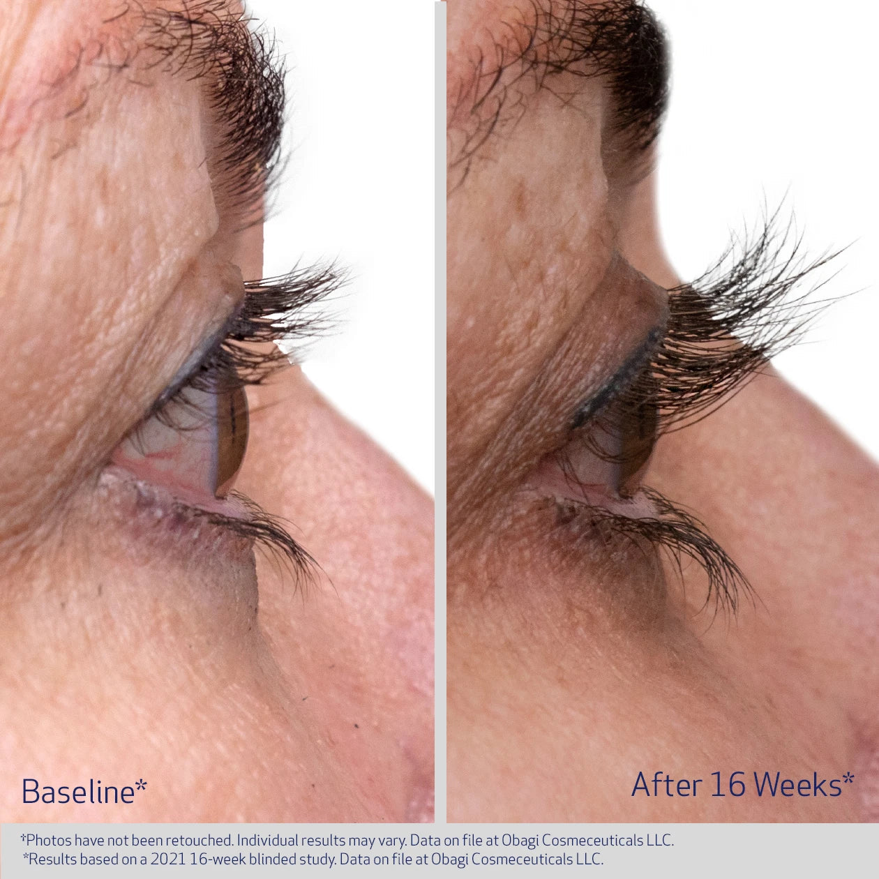 OBAGI NU-CIL® EYELASH ENHANCING SERUM Medical Grade Nourishing Lash Serum
