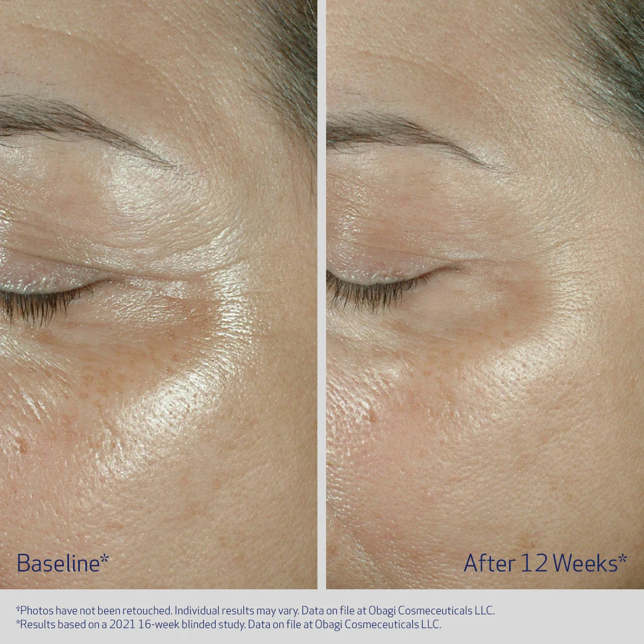 OBAGI ELASTIDERM® EYE CREAM Eye Cream for Fine Lines & Wrinkles