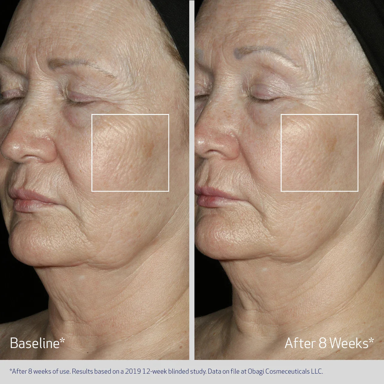 OBAGI ELASTIDERM® FACIAL SERUM Firming Facial Treatment Serum