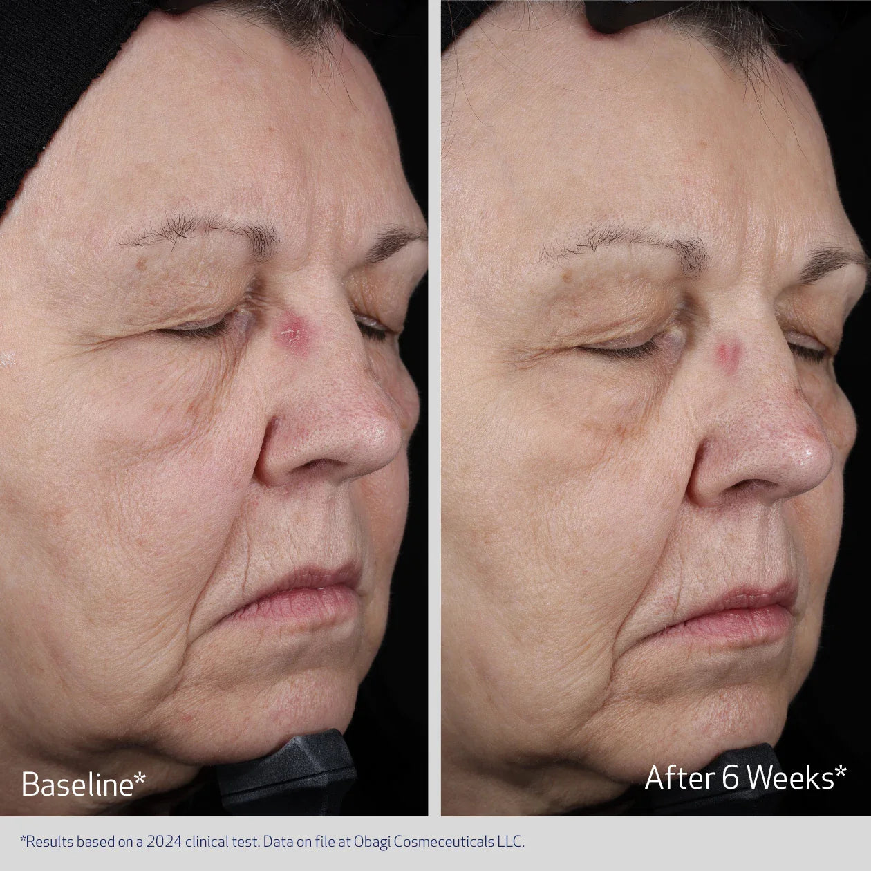 OBAGI ELASTIDERM® LIFT UP & SCULPT FACIAL MOISTURIZER Firming and Plumping Cream