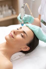MICRONEEDLING