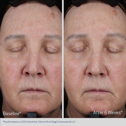 OBAGI ELASTIDERM® LIFT UP & SCULPT FACIAL MOISTURIZER Firming and Plumping Cream
