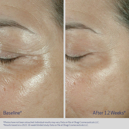 OBAGI ELASTIDERM® EYE CREAM Eye Cream for Fine Lines & Wrinkles