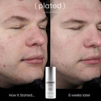PLATED™ DAILY Serum